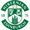 Hibernian FC U20 - U VS Queen Of South Reserves Score